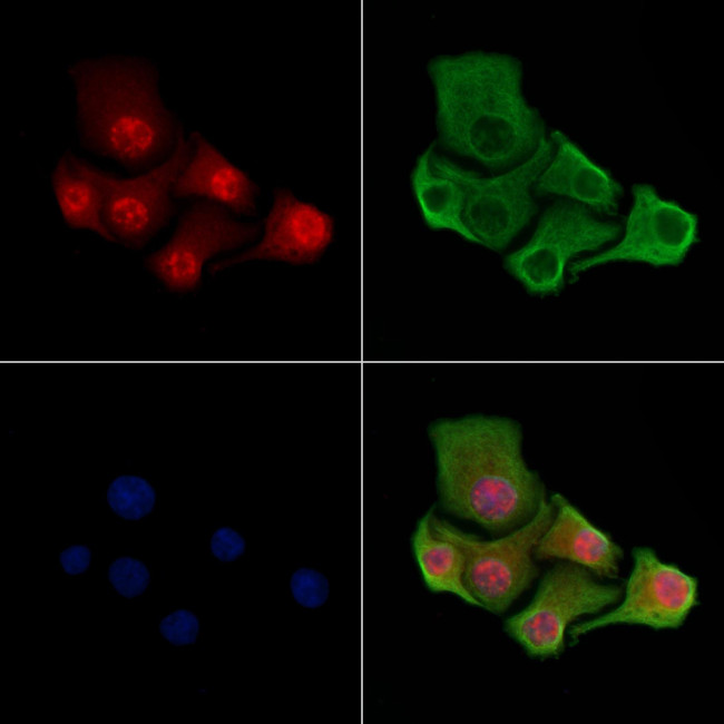 Phospho-TDP-43 (Ser409, Ser410) Antibody in Immunocytochemistry (ICC/IF)