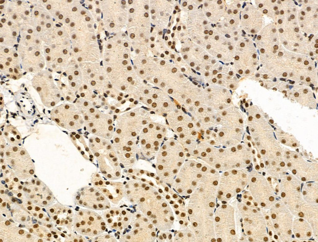 Phospho-TDP-43 (Ser409, Ser410) Antibody in Immunohistochemistry (Paraffin) (IHC (P))