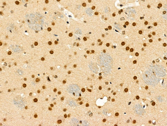 Phospho-TDP-43 (Ser409, Ser410) Antibody in Immunohistochemistry (Paraffin) (IHC (P))