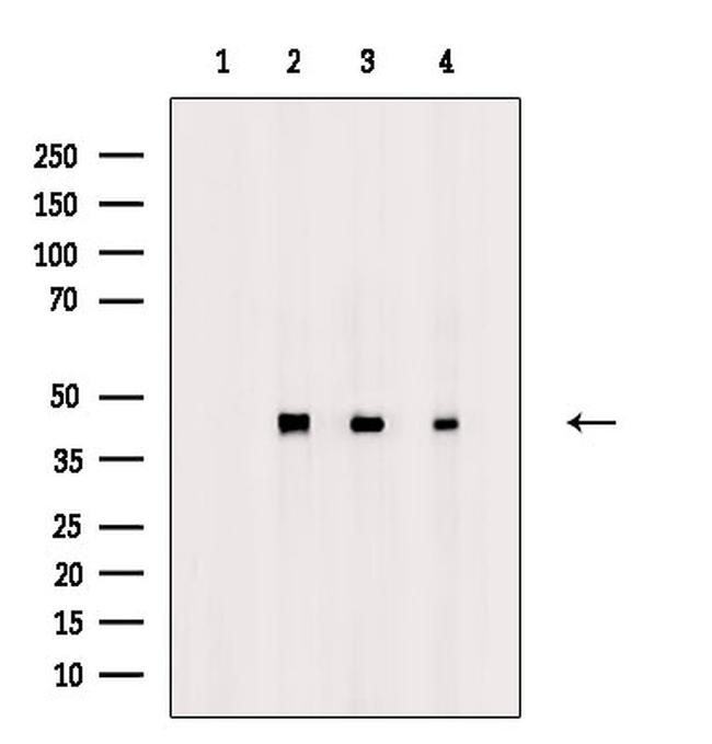 Phospho-TDP-43 (Ser409, Ser410) Antibody in Western Blot (WB)