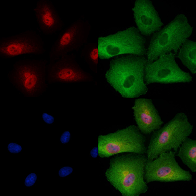 Phospho-TFEB (Ser211) Antibody in Immunocytochemistry (ICC/IF)