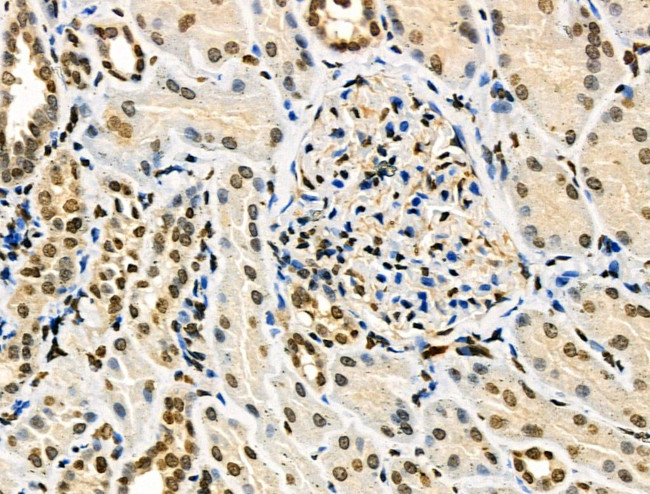 Phospho-TFEB (Ser211) Antibody in Immunohistochemistry (Paraffin) (IHC (P))