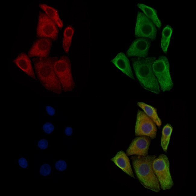 Phospho-TGFBR2 (Ser553) Antibody in Immunocytochemistry (ICC/IF)