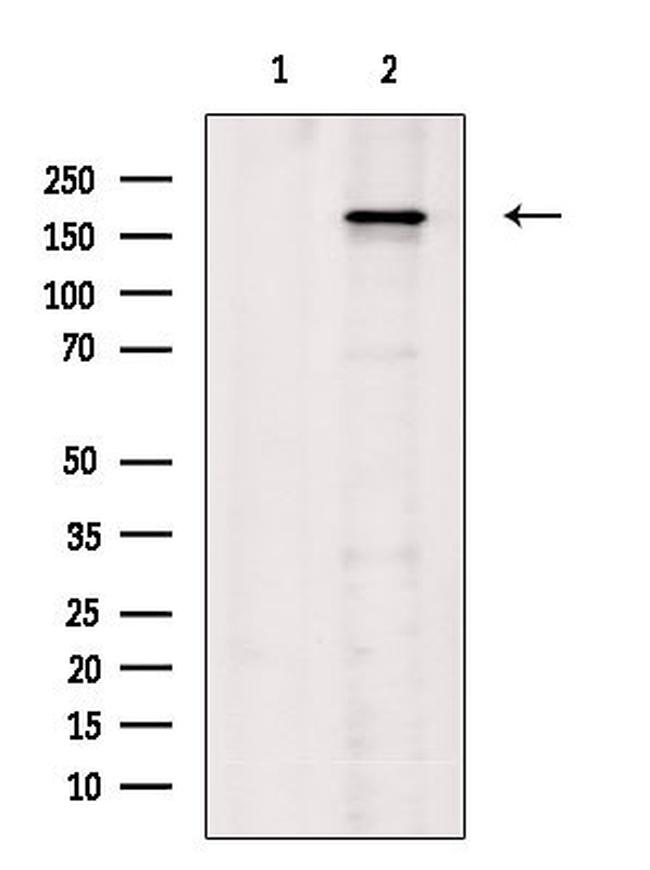 Phospho-VEGF Receptor 1 (Tyr1333) Antibody in Western Blot (WB)