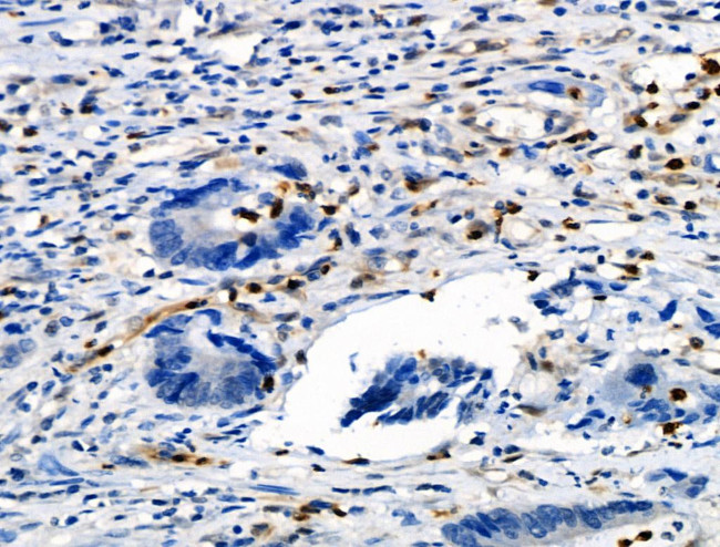 Phospho-Vimentin (Ser39) Antibody in Immunohistochemistry (Paraffin) (IHC (P))