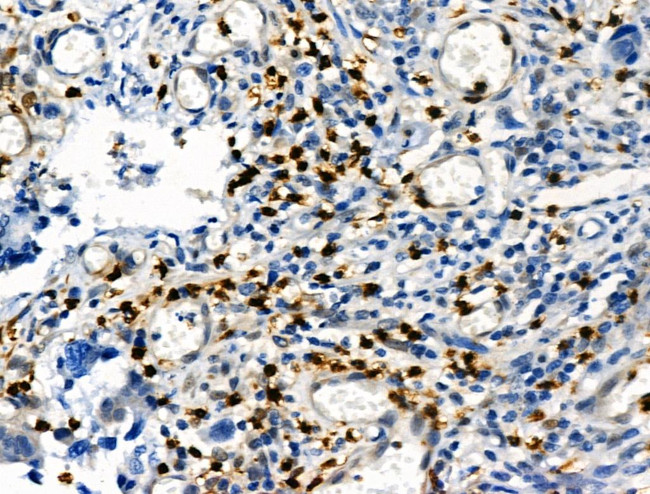 Phospho-Vimentin (Ser39) Antibody in Immunohistochemistry (Paraffin) (IHC (P))