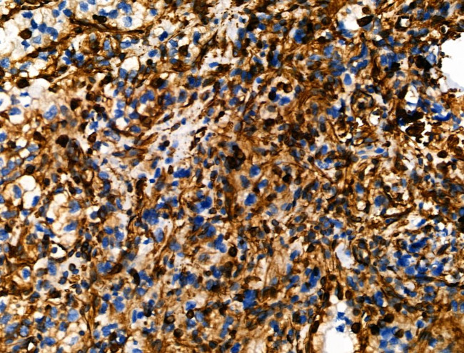 Phospho-Vimentin (Ser39) Antibody in Immunohistochemistry (Paraffin) (IHC (P))