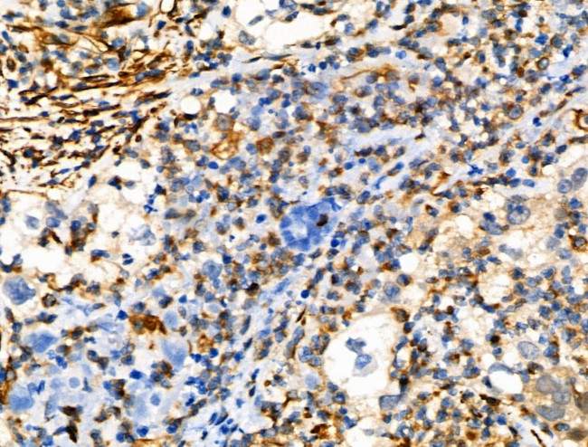 Phospho-Vimentin (Ser39) Antibody in Immunohistochemistry (Paraffin) (IHC (P))