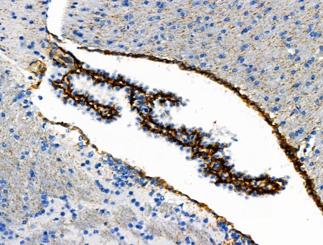 Phospho-Vimentin (Ser39) Antibody in Immunohistochemistry (Paraffin) (IHC (P))