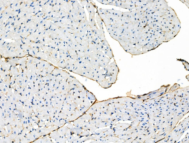 Phospho-Vimentin (Ser39) Antibody in Immunohistochemistry (Paraffin) (IHC (P))