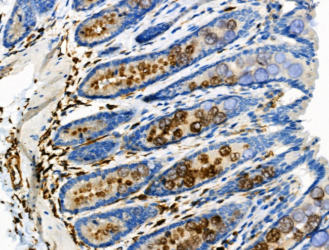 Phospho-Vimentin (Ser39) Antibody in Immunohistochemistry (Paraffin) (IHC (P))