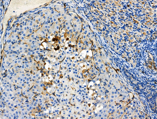 Phospho-Vimentin (Ser39) Antibody in Immunohistochemistry (Paraffin) (IHC (P))