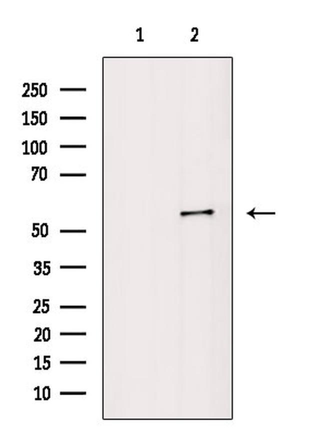 Phospho-Vimentin (Ser39) Antibody in Western Blot (WB)