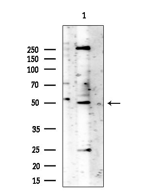 Phospho-Vimentin (Ser39) Antibody in Western Blot (WB)