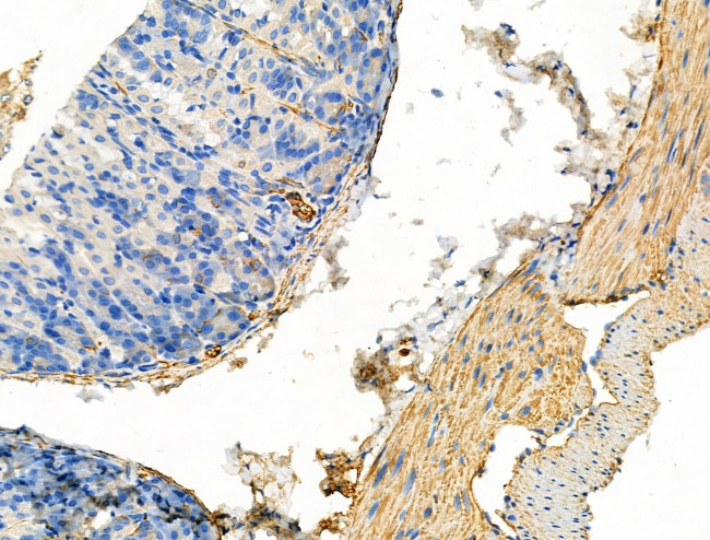 Phospho-WNK4 (Ser575) Antibody in Immunohistochemistry (Paraffin) (IHC (P))