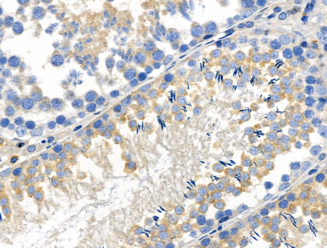 Phospho-WNK4 (Ser575) Antibody in Immunohistochemistry (Paraffin) (IHC (P))