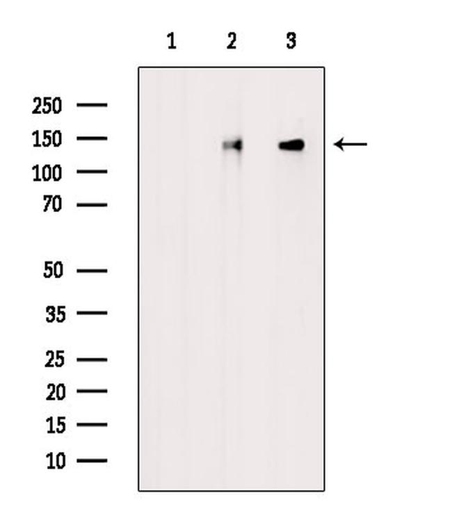 Phospho-WNK4 (Ser575) Antibody in Western Blot (WB)