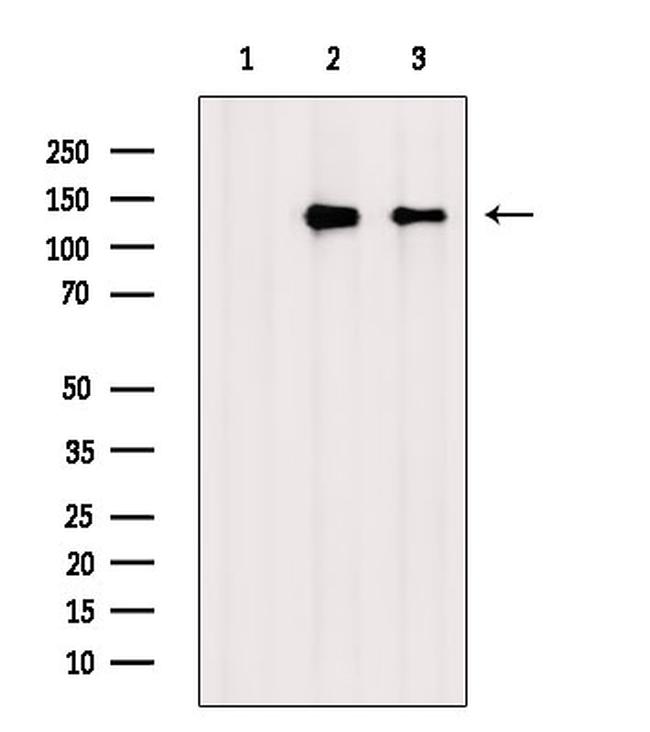 Phospho-ZO-2 (Tyr1118) Antibody in Western Blot (WB)