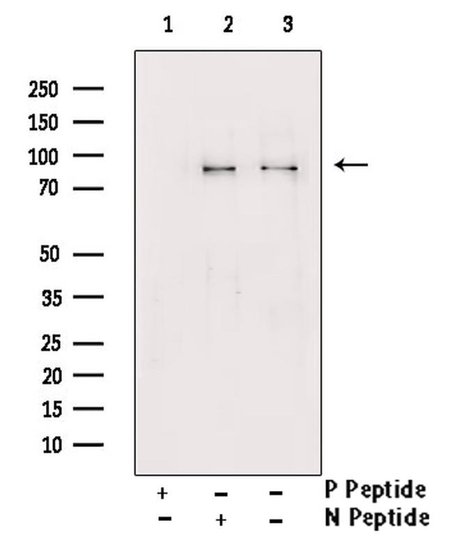 Phospho-GAB2 (Tyr643) Antibody in Western Blot (WB)