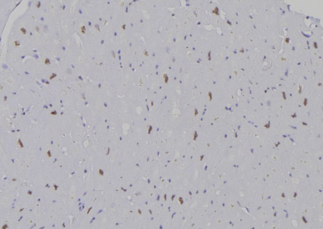 H3K9me1 Antibody in Immunohistochemistry (Paraffin) (IHC (P))