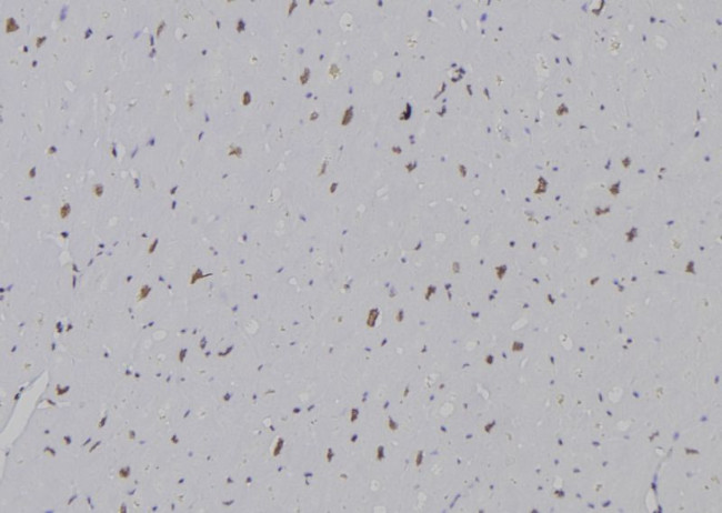 H3K36me2 Antibody in Immunohistochemistry (Paraffin) (IHC (P))