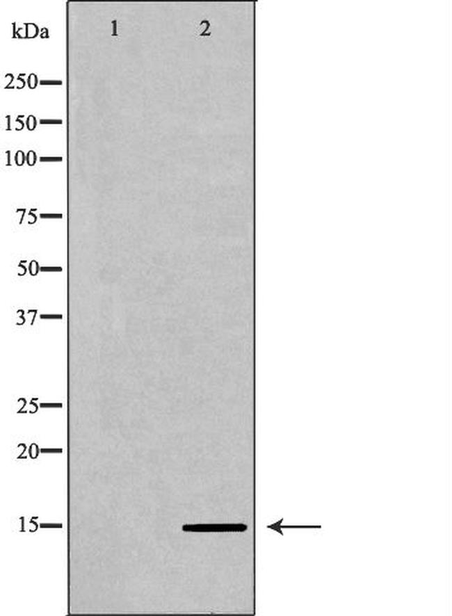 H3K36me2 Antibody in Western Blot (WB)