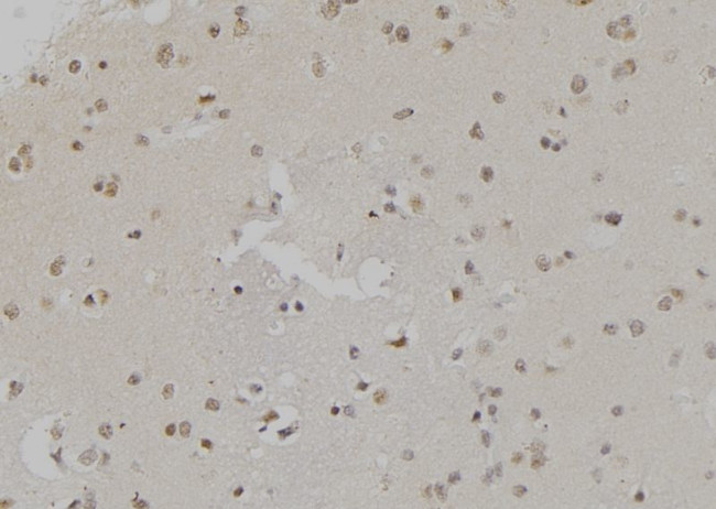 H3K4me2 Antibody in Immunohistochemistry (Paraffin) (IHC (P))