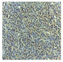 Caspase 3 (Cleaved Asp175) Antibody in Immunohistochemistry (Paraffin) (IHC (P))