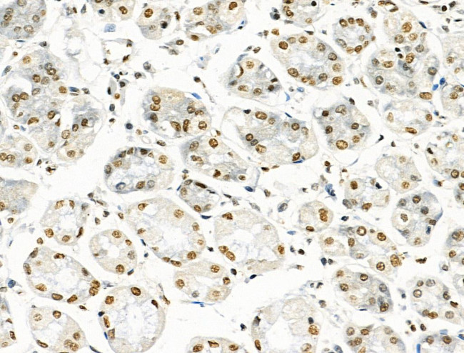 H2A.Zac pan-acetyl (K4,K7,K11,K13) Antibody in Immunohistochemistry (Paraffin) (IHC (P))