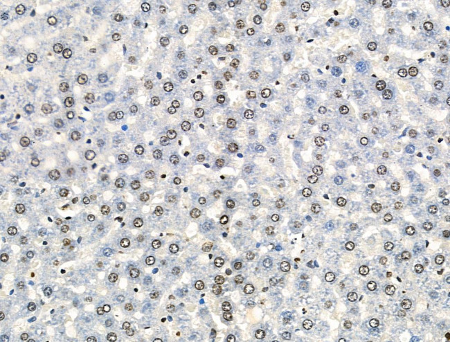 H2A.Zac pan-acetyl (K4,K7,K11,K13) Antibody in Immunohistochemistry (Paraffin) (IHC (P))