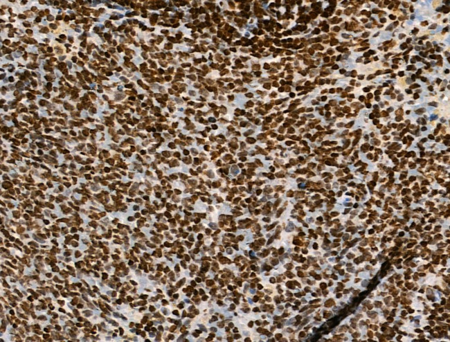 H2A.Zac pan-acetyl (K4,K7,K11,K13) Antibody in Immunohistochemistry (Paraffin) (IHC (P))