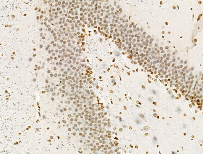 H2A.Zac pan-acetyl (K4,K7,K11,K13) Antibody in Immunohistochemistry (Paraffin) (IHC (P))