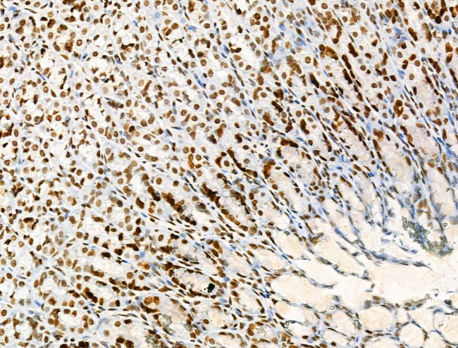 H2A.Zac pan-acetyl (K4,K7,K11,K13) Antibody in Immunohistochemistry (Paraffin) (IHC (P))