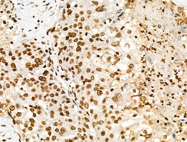 H2A.Zac pan-acetyl (K4,K7,K11,K13) Antibody in Immunohistochemistry (Paraffin) (IHC (P))