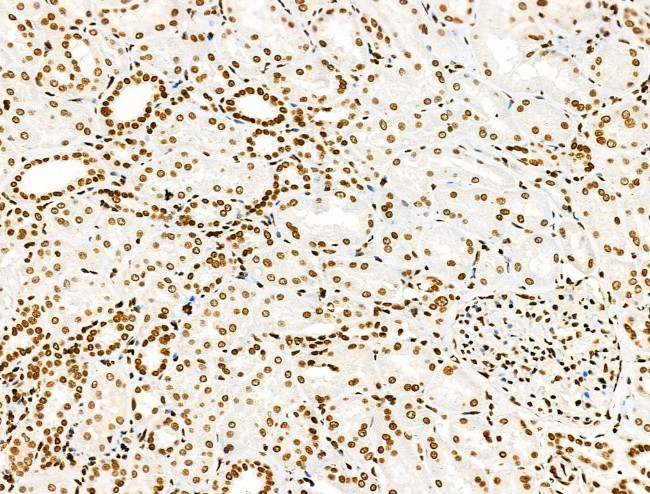 H2A.Zac pan-acetyl (K4,K7,K11,K13) Antibody in Immunohistochemistry (Paraffin) (IHC (P))