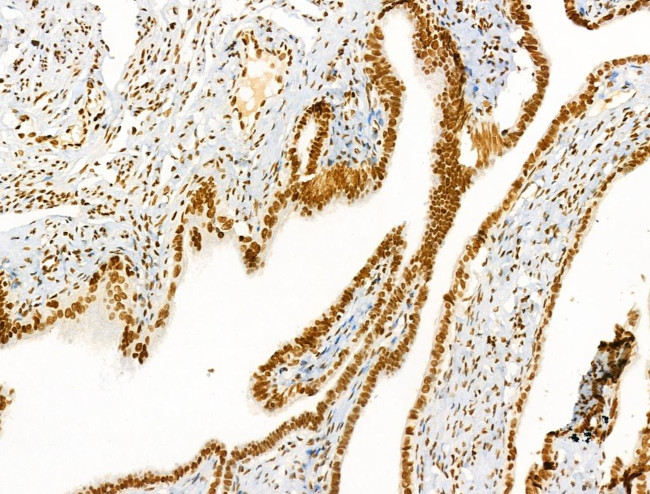 H2A.Zac pan-acetyl (K4,K7,K11,K13) Antibody in Immunohistochemistry (Paraffin) (IHC (P))