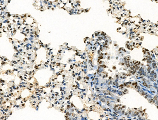 H2A.Zac pan-acetyl (K4,K7,K11,K13) Antibody in Immunohistochemistry (Paraffin) (IHC (P))