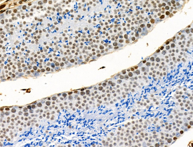 H2A.Zac pan-acetyl (K4,K7,K11,K13) Antibody in Immunohistochemistry (Paraffin) (IHC (P))