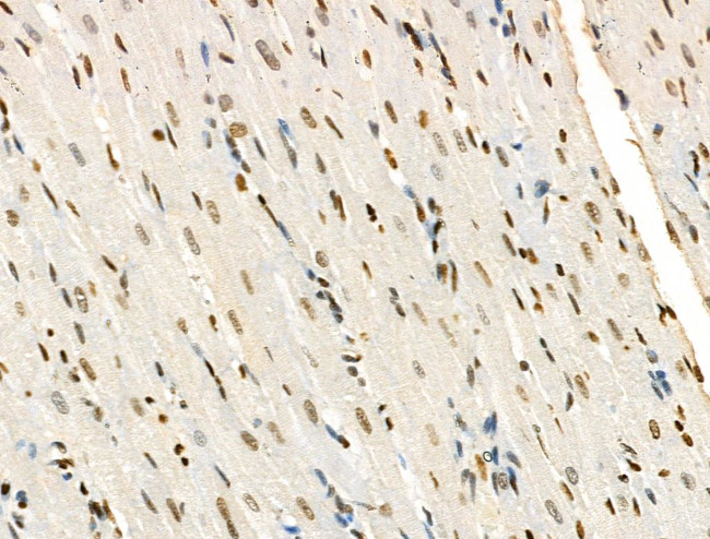 H2A.Zac pan-acetyl (K4,K7,K11,K13) Antibody in Immunohistochemistry (Paraffin) (IHC (P))