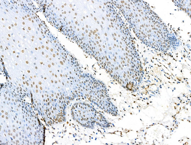 H2BK5ac Antibody in Immunohistochemistry (Paraffin) (IHC (P))