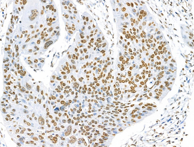 H2BK5ac Antibody in Immunohistochemistry (Paraffin) (IHC (P))