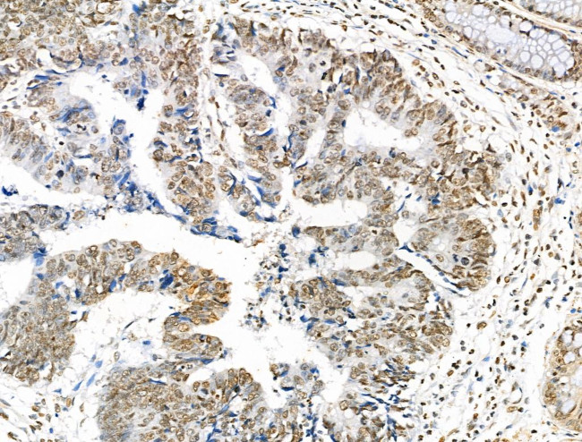 H2BK5ac Antibody in Immunohistochemistry (Paraffin) (IHC (P))