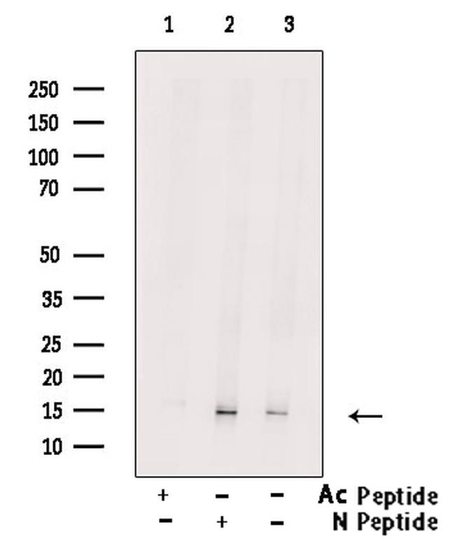 H2BK5ac Antibody in Western Blot (WB)