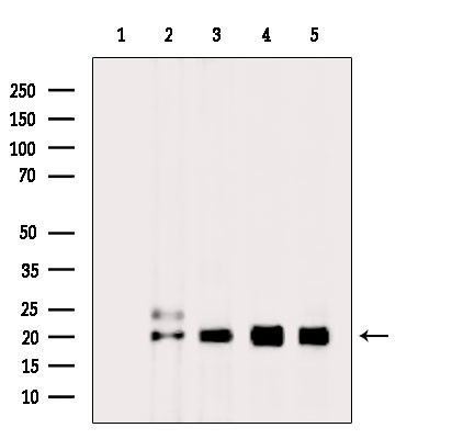 H2BK20ac Antibody in Western Blot (WB)