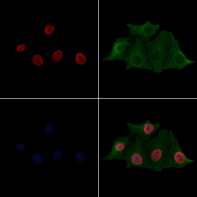 H2BK20ac Antibody in Immunocytochemistry (ICC/IF)