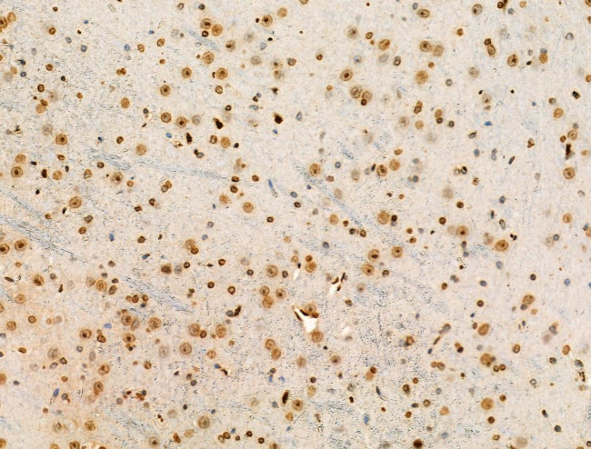 H2BK20ac Antibody in Immunohistochemistry (Paraffin) (IHC (P))