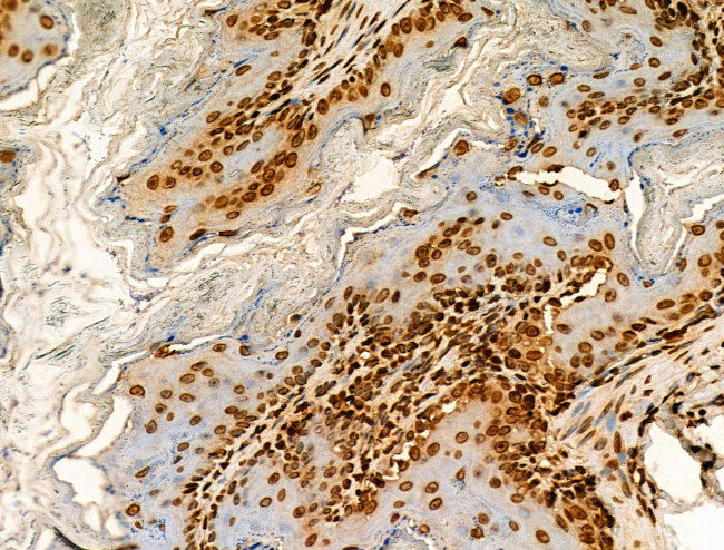 H2BK20ac Antibody in Immunohistochemistry (Paraffin) (IHC (P))