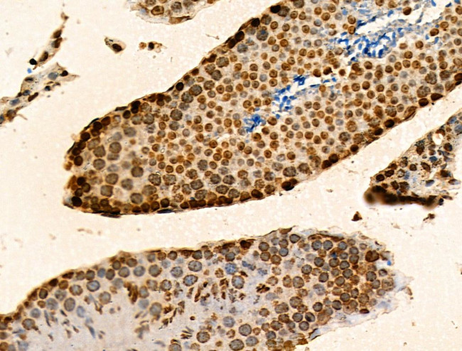 H2BK20ac Antibody in Immunohistochemistry (Paraffin) (IHC (P))