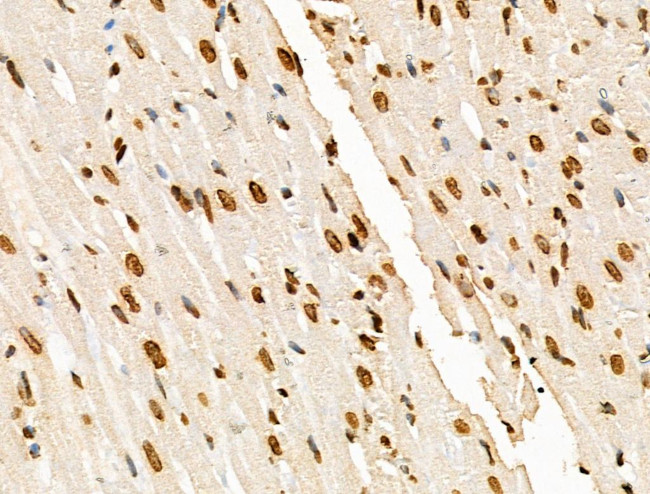 H2BK20ac Antibody in Immunohistochemistry (Paraffin) (IHC (P))