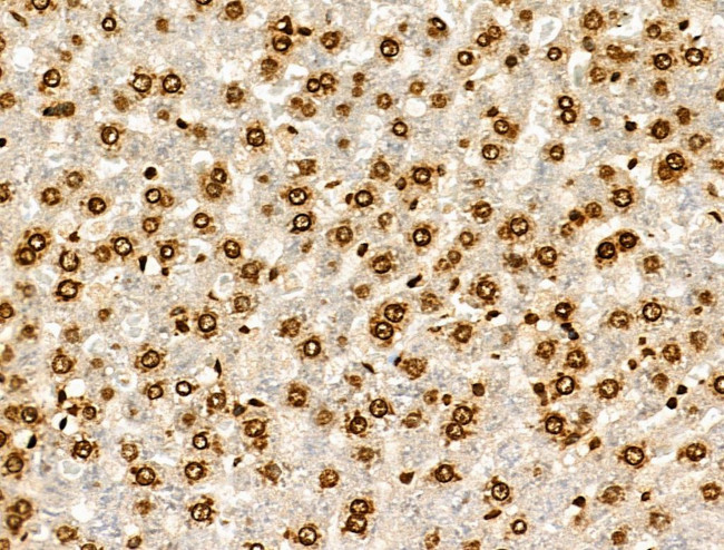 H2BK20ac Antibody in Immunohistochemistry (Paraffin) (IHC (P))